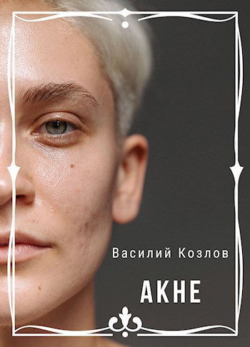 Обложка книги Акне